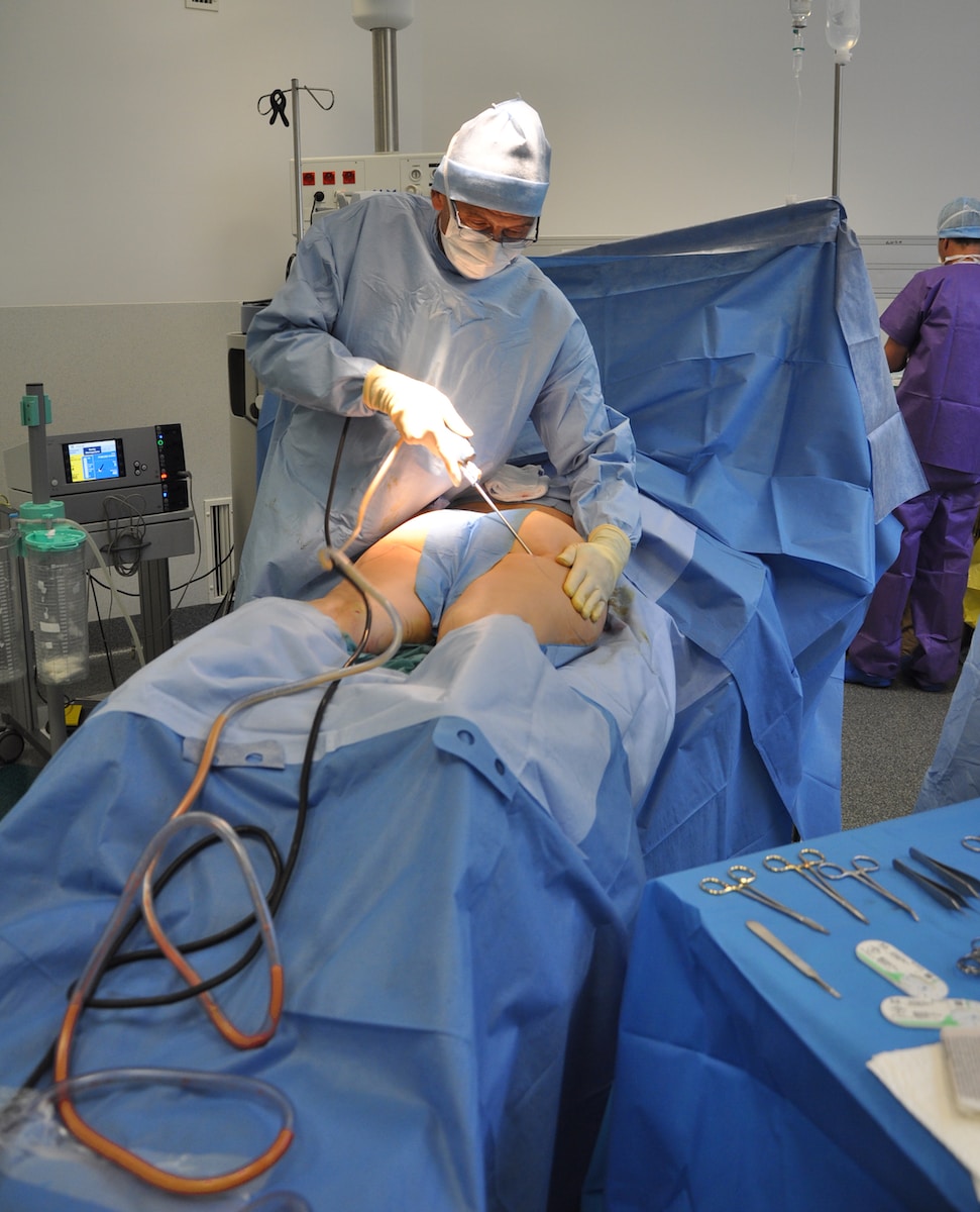 Enhancing Body Confidence: How Liposuction in Turkey Can Transform Your Figure 1 liposuction-in-Turkey-guide