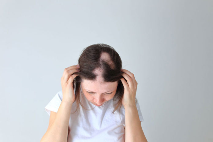 hair-transplant-techniques.